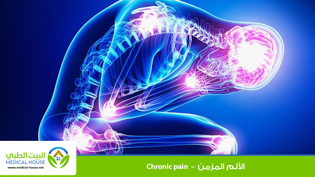 الألم المزمن - Chronic Pain