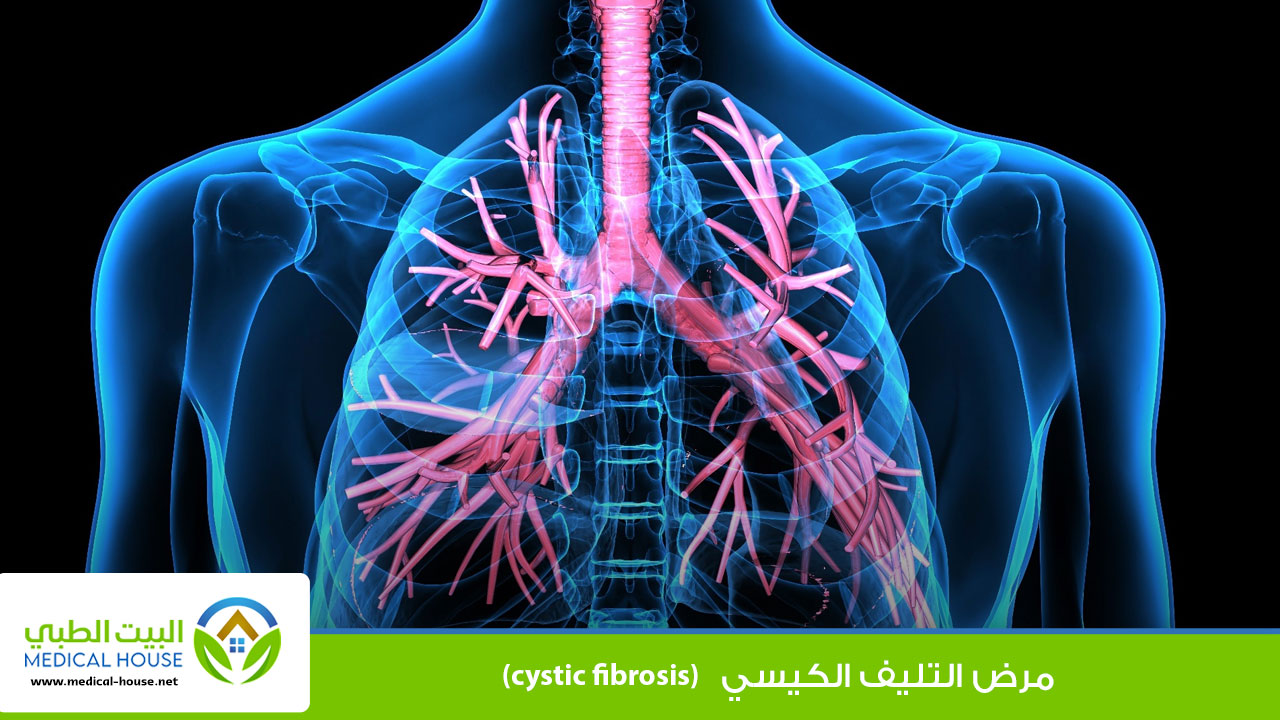 التليف الكيسي cystic fibrosis