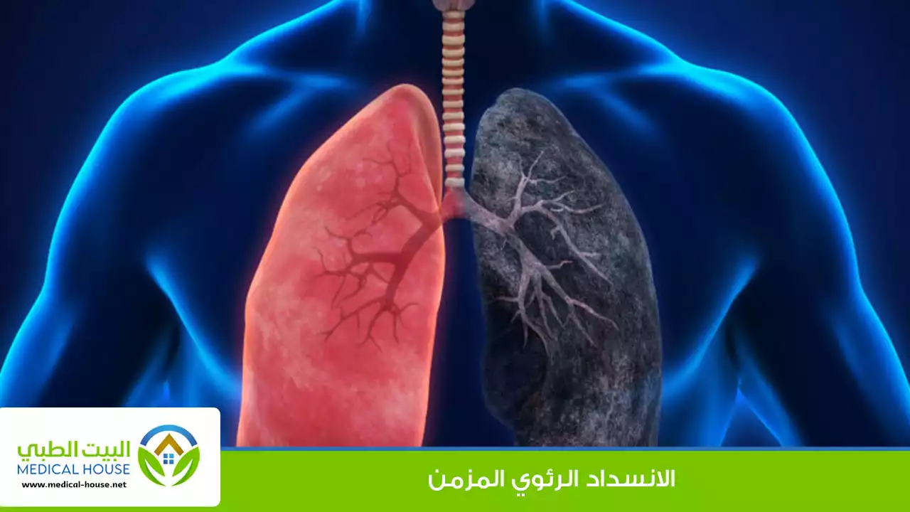 الانسداد الرئوي المزمن (COPD)